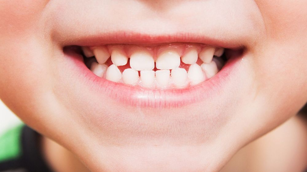 Un médicament qui fait repousser les dents : les scientifiques se rapprochent des essais cliniques