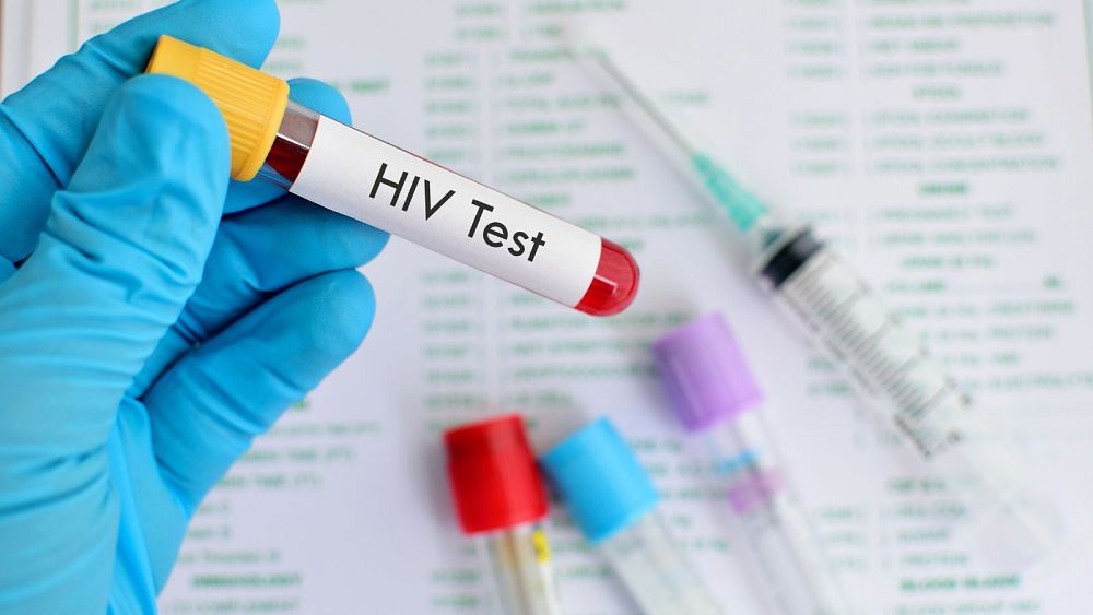 Un « patient genevois » devient le premier à être guéri du VIH après une greffe « normale » de cellules souches