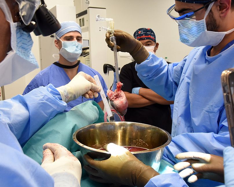 Médecins effectuant une transplantation cardiaque expérimentale chez un porc.