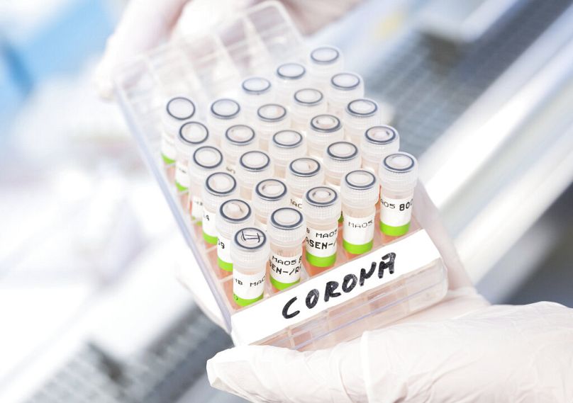 Un assistant biologique et technique montre des tests PCR préparés pour le COVID-19 à Hanovre, janvier 2022