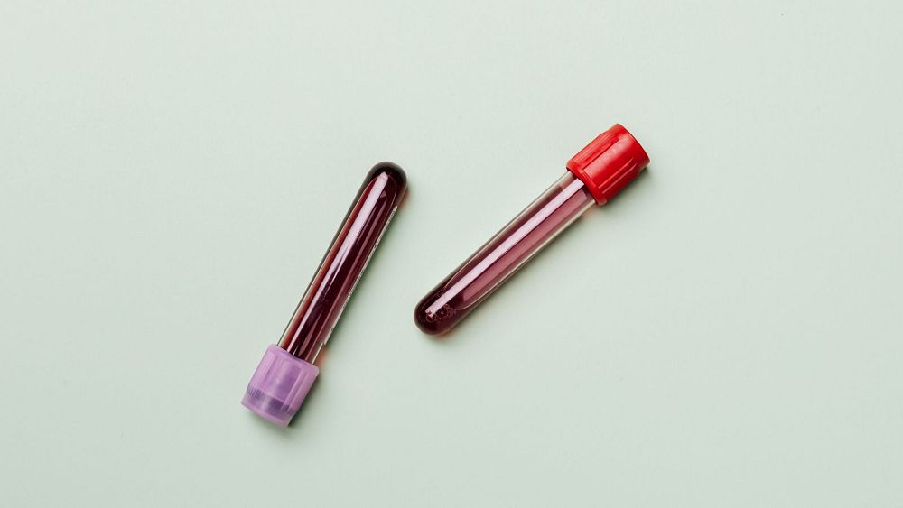 Des scientifiques d'Oxford développent un nouveau test sanguin capable de détecter le risque de maladie de Parkinson avec une précision de 90 %