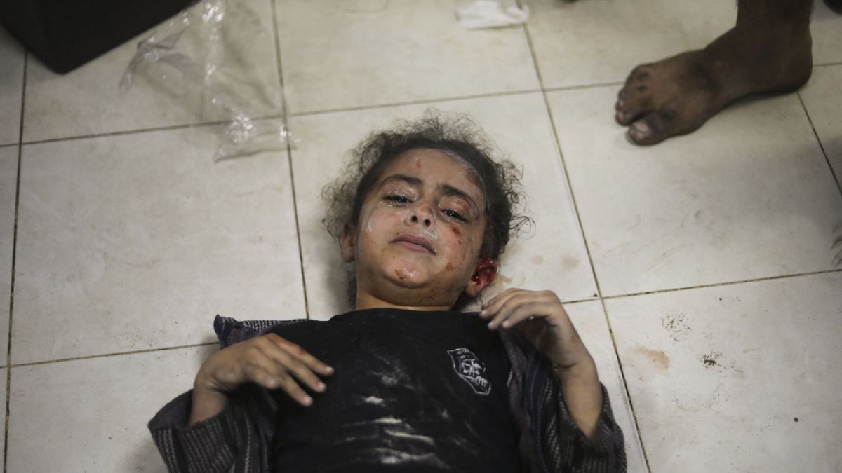 A Palestinian child wounded during the Israeli bombardment of the Gaza Strip Saturday, Jan. 6, 2024.