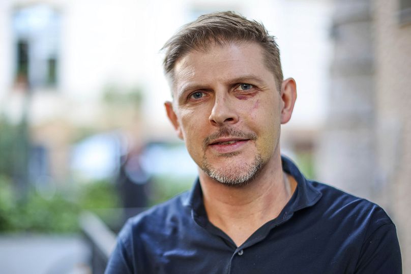 L'eurodéputé Matthias Ecke lors d'un événement de campagne électorale à Leipzig, en Allemagne, le lundi 13 mai 2024, après son attentat à Dresde une semaine plus tôt.