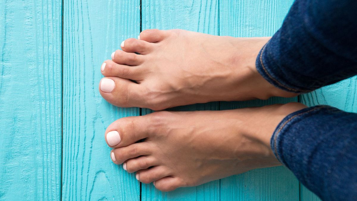 Does having flat feet make you more susceptible to health problems?