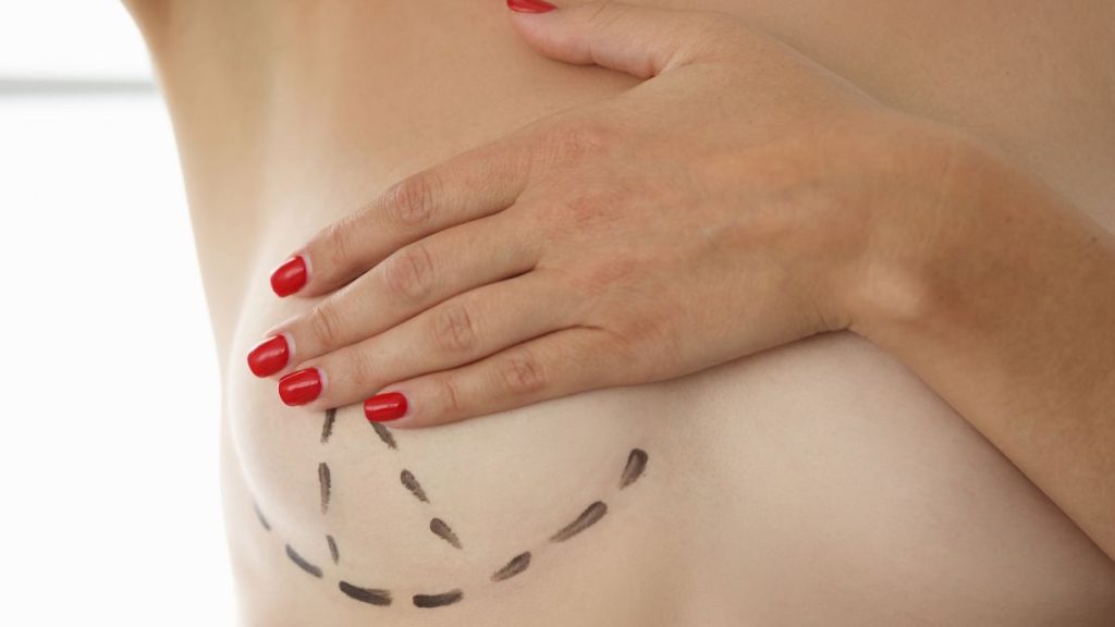 Breast augmentation is one of the most popular cosmetic procedures.