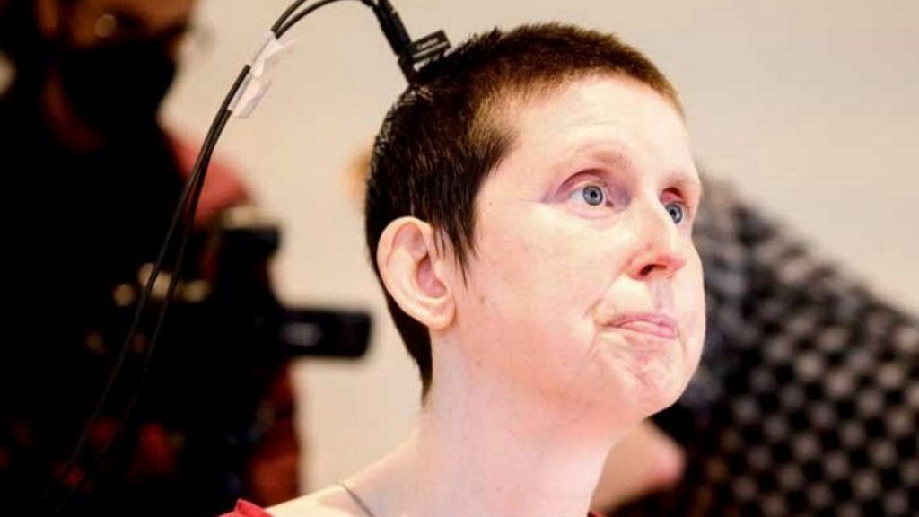 This photo provided by researchers at UCSF and UC Berkeley shows Ann, a participant in a study on speech neuroprostheses, in California in 2023.