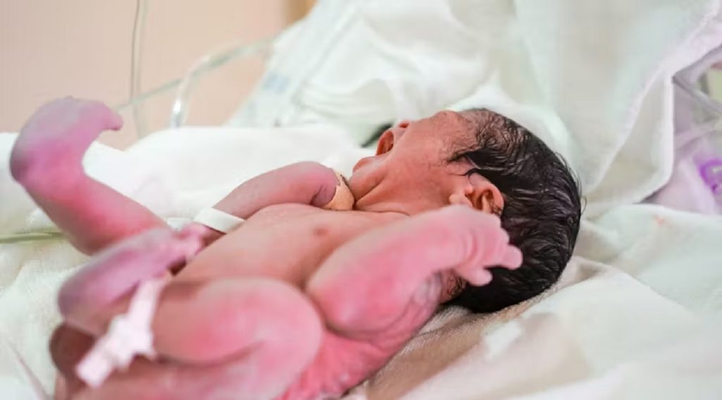 La vérité glaçante derrière le phénomène du bébé sirène