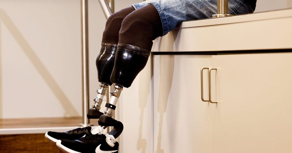 Le responsable du Kremlin salue la guerre de l'Ukraine pour avoir aidé `` Great Leap '' dans les prothèses