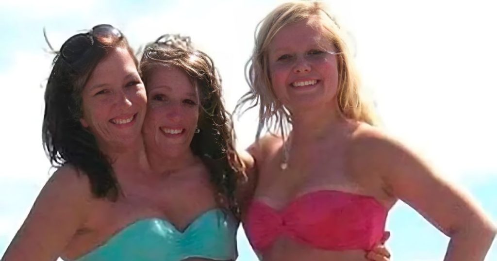 Les célèbres siamoises Abby et Brittany fêtent leurs 33 ans