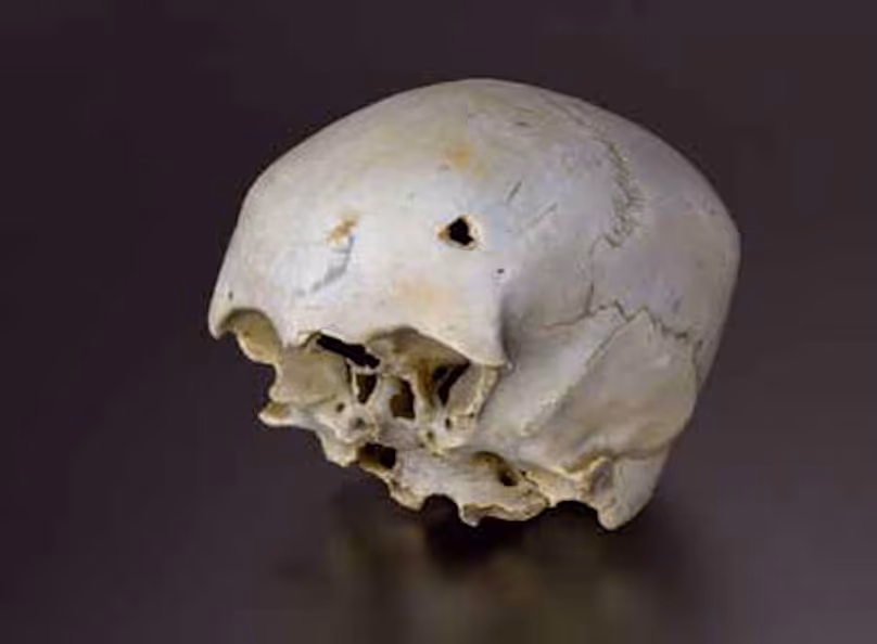 Image d'un crâne trouvé
